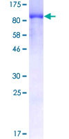 12.5% SDS-PAGE Stained with Coomassie Blue.